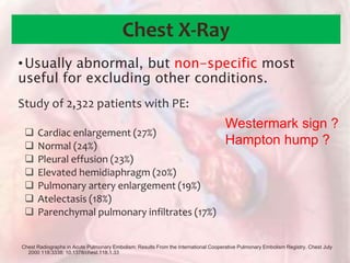 Chest X-Ray
Study of 2,322 patients with PE:
 Cardiac enlargement (27%)
 Normal (24%)
 Pleural effusion (23%)
 Elevated hemidiaphragm (20%)
 Pulmonary artery enlargement (19%)
 Atelectasis (18%)
 Parenchymal pulmonary infiltrates (17%)
•Usually abnormal, but non-specific most
useful for excluding other conditions.
Chest Radiographs in Acute Pulmonary Embolism: Results From the International Cooperative Pulmonary Embolism Registry. Chest July
2000 118:3338; 10.1378/chest.118.1.33
Westermark sign ?
Hampton hump ?
 