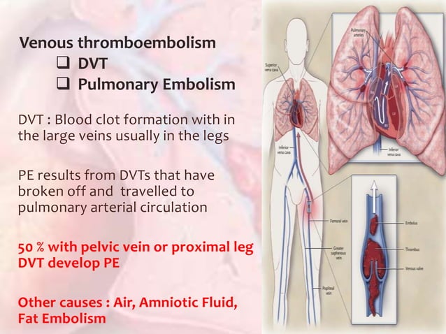 Acute Pulmonary Embolism | PPTX | Blood Disorders | Diseases and Conditions