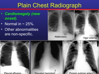 Plain Chest Radiograph
• Cardiomegaly (new
  onset).
• Normal in ~ 25%.
• Other abnormalities
  are non-specific.
                        Atelectasis   Hge/ edema
 