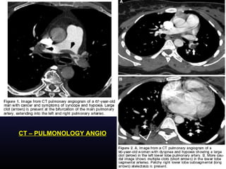 CT – PULMONOLOGY ANGIO
 