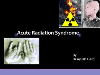 Acute Radiation Syndrome
By
Dr.Ayush Garg
 