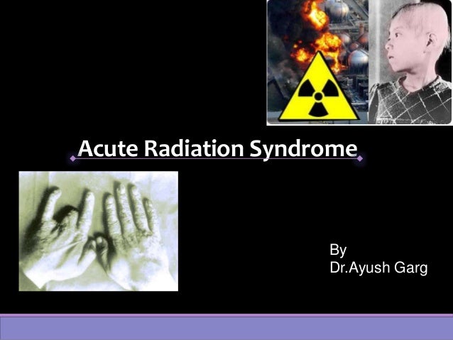 Acute Radiation Syndrome
