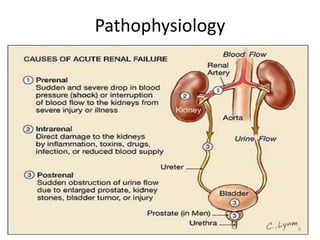 Acute renal disease | PPTX
