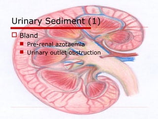 Acute renal failure | PPT