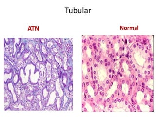acute renal