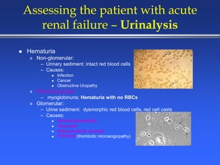 Assessing the patient with acute
renal failure – Urinalysis
 Hematuria
» Non-glomerular:
– Urinary sediment: intact red blood cells
– Causes:
 Infection
 Cancer
 Obstructive Uropathy
» Rhabdomyolysis
– myoglobinuria; Hematuria with no RBCs
» Glomerular:
– Urine sediment: dysmorphic red blood cells, red cell casts
– Causes:
 Glomerulonephritis
 Vasculitis
 Atheroembolic disease
 TTP/HUS (thombotic microangiopathy)
 
