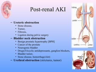 Post-renal AKI

– Ureteric obstruction
   •   Stone disease,
   •   Tumor,
   •   Fibrosis,
   •   Ligation during pelvic surgery
– Bladder neck obstruction
   •   Benign prostatic hypertrophy [BPH]
   •   Cancer of the prostate
   •   Neurogenic bladder
   •   Drugs(Tricyclic antidepressants, ganglion blockers,
   •   Bladder tumor,
   •   Stone disease, hemorrhage/clot)
– Urethral obstruction (strictures, tumor)
 