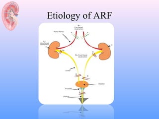 Etiology of ARF
 