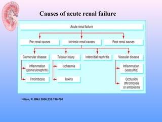 Causes of acute renal failure




Hilton, R. BMJ 2006;333:786-790
 