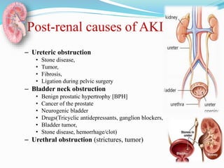 Post-renal causes of AKI
– Ureteric obstruction
• Stone disease,
• Tumor,
• Fibrosis,
• Ligation during pelvic surgery
– Bladder neck obstruction
• Benign prostatic hypertrophy [BPH]
• Cancer of the prostate
• Neurogenic bladder
• Drugs(Tricyclic antidepressants, ganglion blockers,
• Bladder tumor,
• Stone disease, hemorrhage/clot)
– Urethral obstruction (strictures, tumor)
 