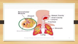 Acute respiratory distress syndrome.pptx