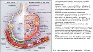 ACUTE RESPIRATORY DISTRESS SYNDROME (ARDS).pptx