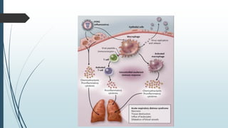 Acute Respiratory Distress Syndrome | PDF