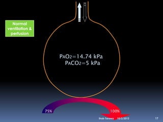 Normal
ventilation &
 perfusion




                      PAO2=14.74 kPa
                        PACO2=5 kPa




                75%                       100%
                                  Ihab Tarawa   10/2/2012   17
 