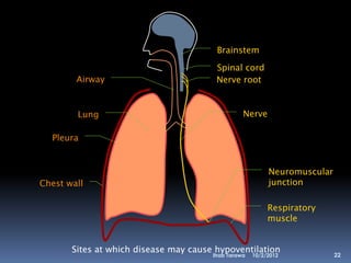 Brainstem

                                        Spinal cord
        Airway                          Nerve root


        Lung                                     Nerve

  Pleura


                                                          Neuromuscular
Chest wall                                                junction

                                                          Respiratory
                                                          muscle


       Sites at which disease may cause hypoventilation
                                       Ihab Tarawa   10/2/2012            22
 