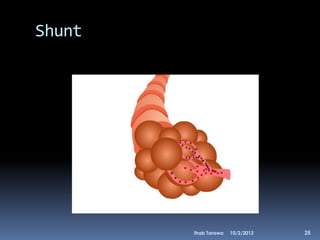 Shunt




        Ihab Tarawa   10/2/2012   25
 