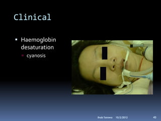 Clinical

 Haemoglobin
  desaturation
   cyanosis




                 Ihab Tarawa   10/2/2012   43
 