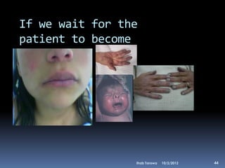 If we wait for the
patient to become
cyanosed




                 Ihab Tarawa   10/2/2012   44
 
