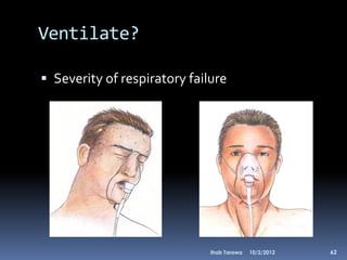 Ventilate?

 Severity of respiratory failure




                              Ihab Tarawa   10/2/2012   62
 