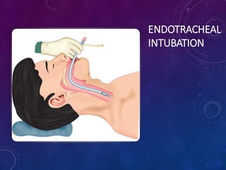 ENDOTRACHEAL
INTUBATION
 