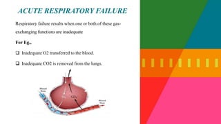 Acute_respiratory_failure[1] [Autosaved].pptx