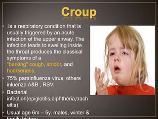 Acute respiratory infections in children | PPTX