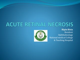 Bipin Bista
Resident
Ophthalmology
National medical College
& Teaching Hospital
 