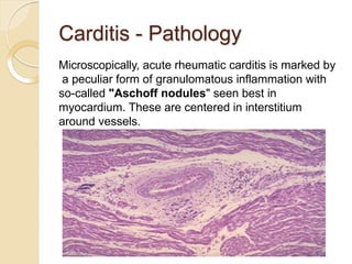 basics of Acute Rhematic Fever in children.pptx