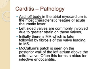 Carditis – Pathology
 Aschoff body in the atrial myocardium is
the most characteristic feature of acute
rheumatic fever.
 Left sided valves are commonly involved
due to greater strain on these valves.
 Initially there is MR which is later
followed by fibrosis of the valve leading
to MS.
 McCallum’s patch is seen on the
posterior wall of the left atrium above the
mitral valve. Often this forms a nidus for
infective endocarditis.
 