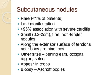 Subcutaneous nodules
 Rare (<1% of patients)
 Late manifestation
 >95% association with severe carditis
 Small (0.2-2cm), firm, non-tender
nodules
 Along the extensor surface of tendons
near bony prominences
 Other sites – behind ears, occipital
region, spine
 Appear in crops
 Biopsy – Aschoff bodies
 