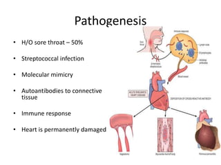 Pathogenesis
• H/O sore throat – 50%
• Streptococcal infection
• Molecular mimicry
• Autoantibodies to connective
tissue
• Immune response
• Heart is permanently damaged
 