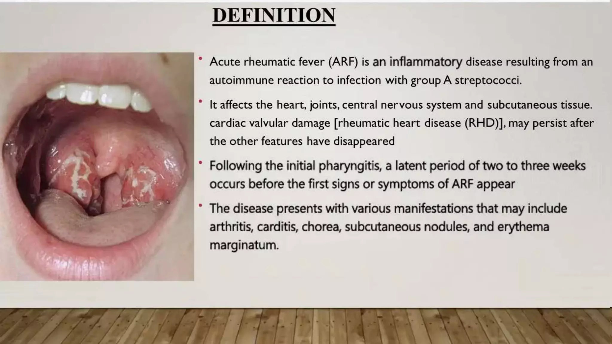 Acute Rheumatic Fever.pptx