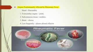  Organs Predominantly Affected by Rheumatic Fever
Heart—Pancarditis
1. Extracardiac organs – joints.
2. Subcutaneous tissue—nodules.
3. Brain – chorea.
4. Less frequently – pleura–pleural effusion
 