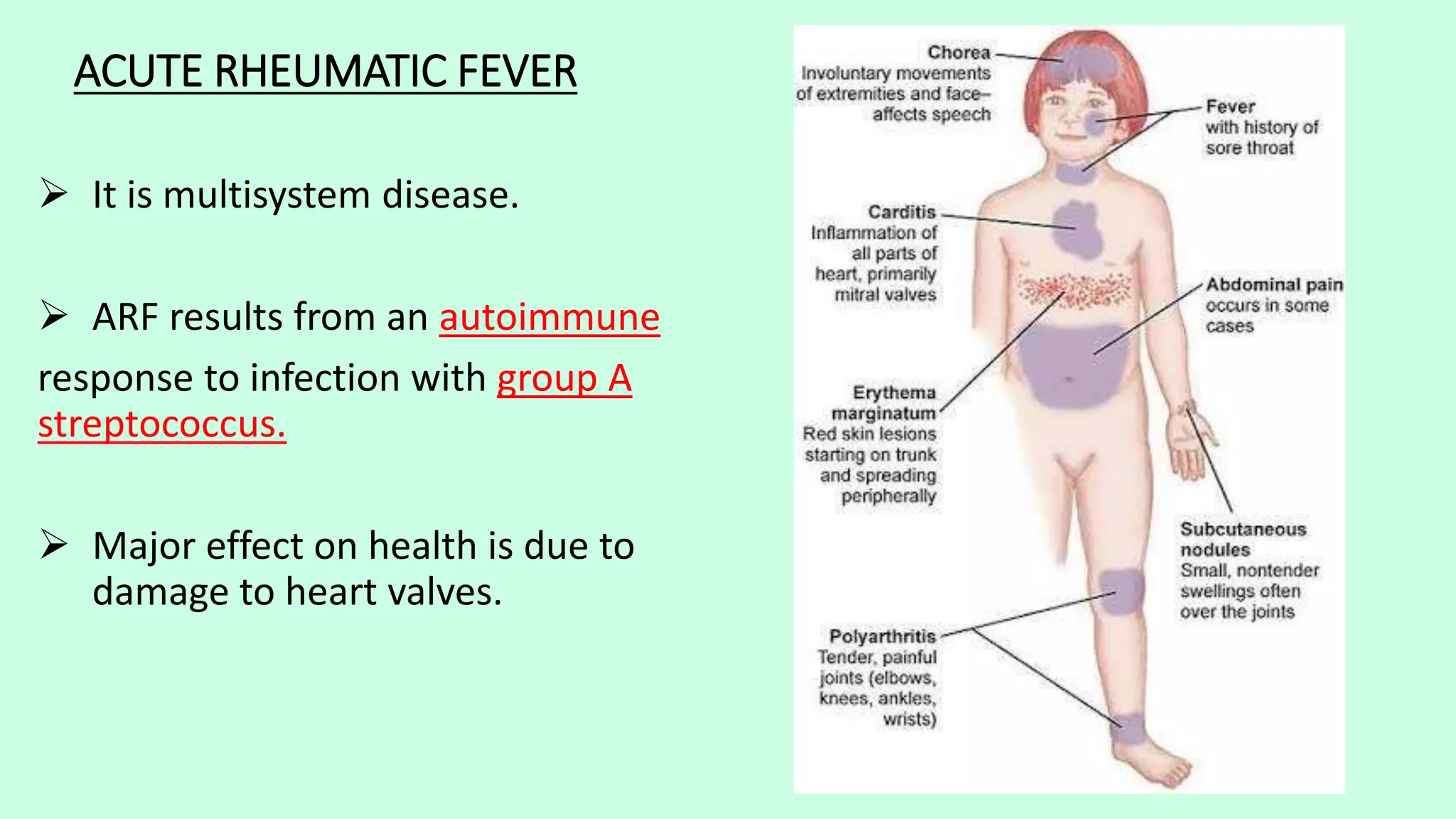 Acute Rheumatic Fever PPTX acute-rheumatic-fever-pptx