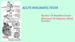 ACUTE RHEUMATIC FEVER
Speaker: Dr Ramdhan kumar
Moderator: Dr Dipankar Ghosh
Dastidar
 