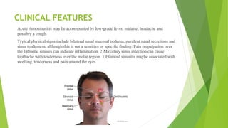 CLINICAL FEATURES
Acute rhinosinusitis may be accompanied by low‐grade fever, malaise, headache and
possibly a cough.
Typical physical signs include bilateral nasal mucosal oedema, purulent nasal secretions and
sinus tenderness, although this is not a sensitive or specific finding. Pain on palpation over
the 1)frontal sinuses can indicate inflammation. 2)Maxillary sinus infection can cause
toothache with tenderness over the molar region. 3)Ethmoid sinusitis maybe associated with
swelling, tenderness and pain around the eyes.
 