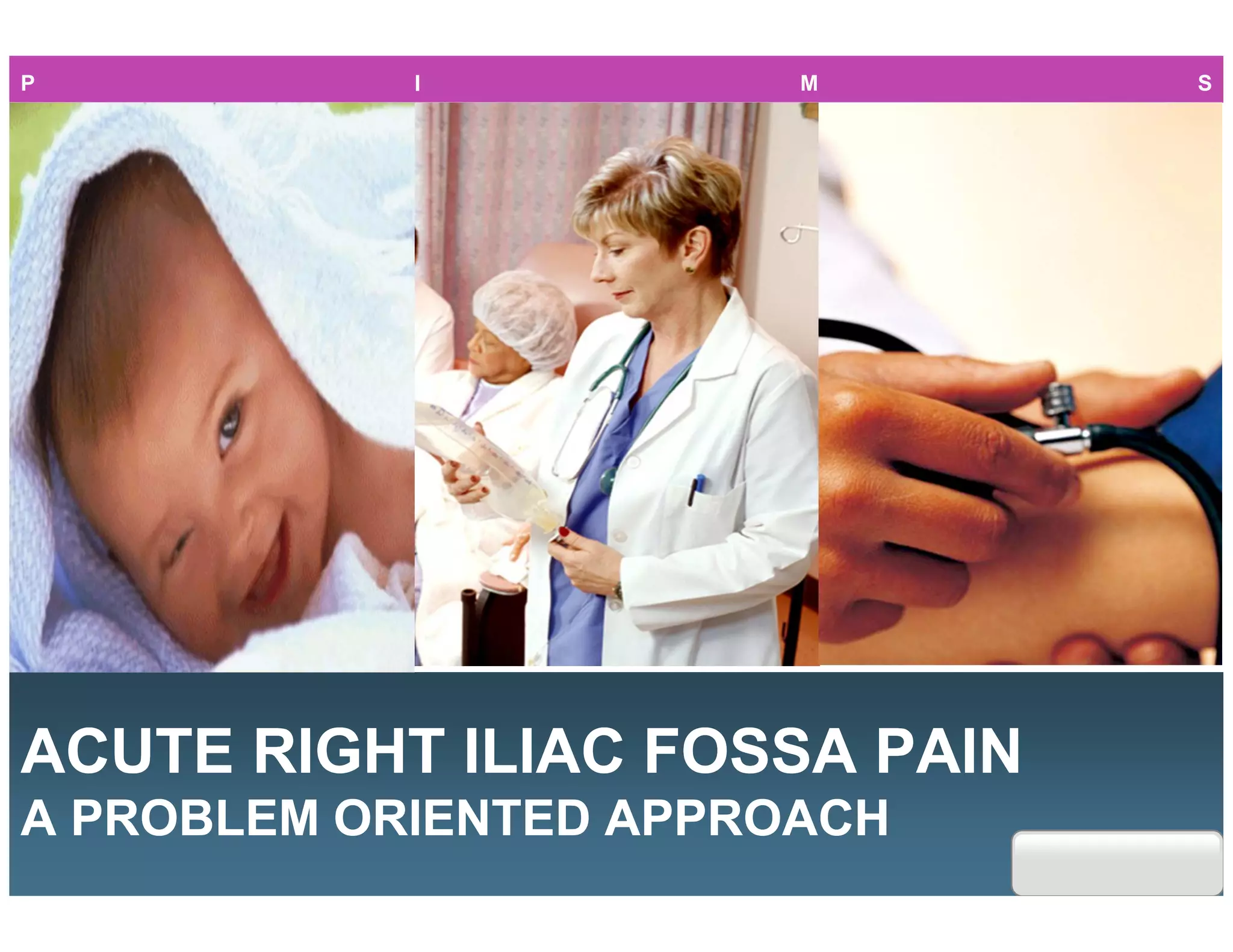 Acute right iliac fossa pain- the commonest surgical emergency | PDF