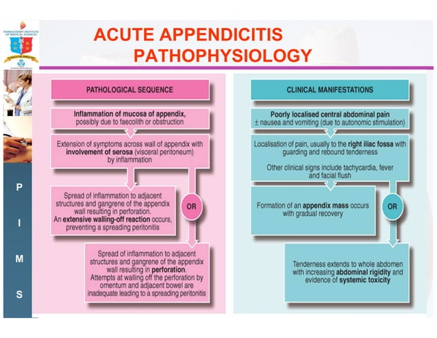 Acute right iliac fossa pain- the commonest surgical emergency | PDF