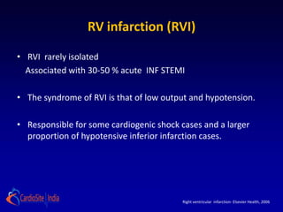 Acute rv failure physiology to management | PPT