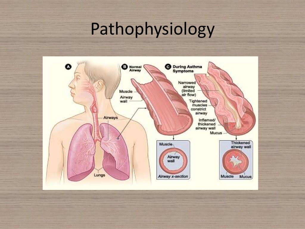 Acute severe asthma