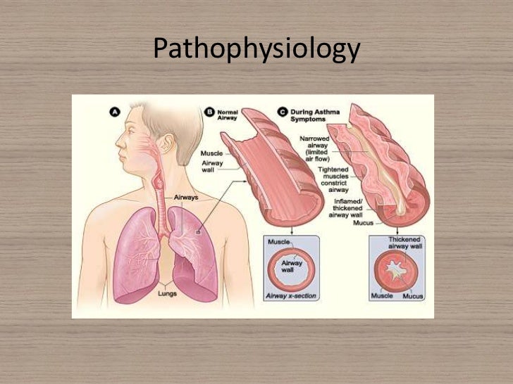 Acute severe asthma