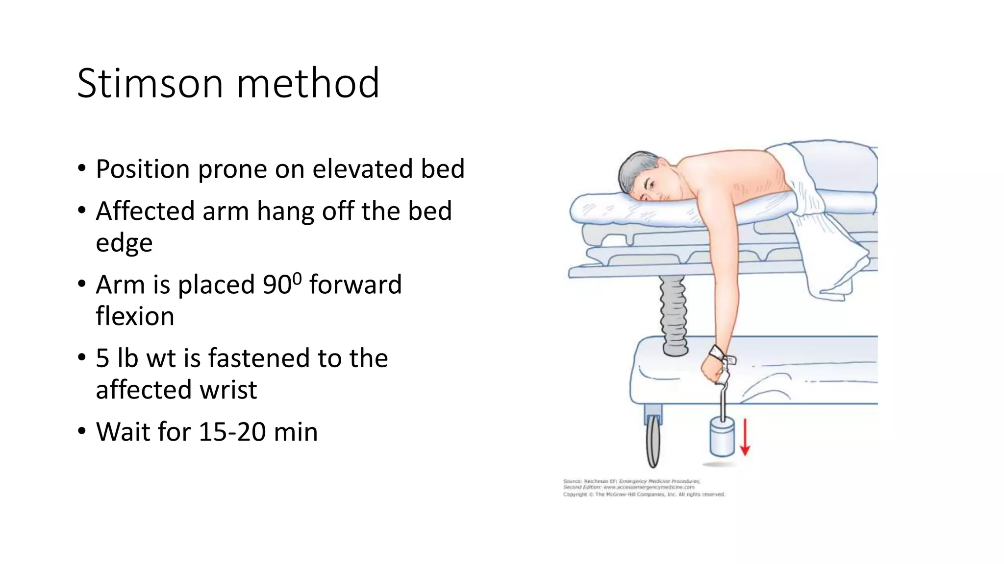 Stimson method
• Position prone on elevated bed
• Affected arm hang off the bed
edge
• Arm is placed 900 forward
flexion
• 5 lb wt is fastened to the
affected wrist
• Wait for 15-20 min
 