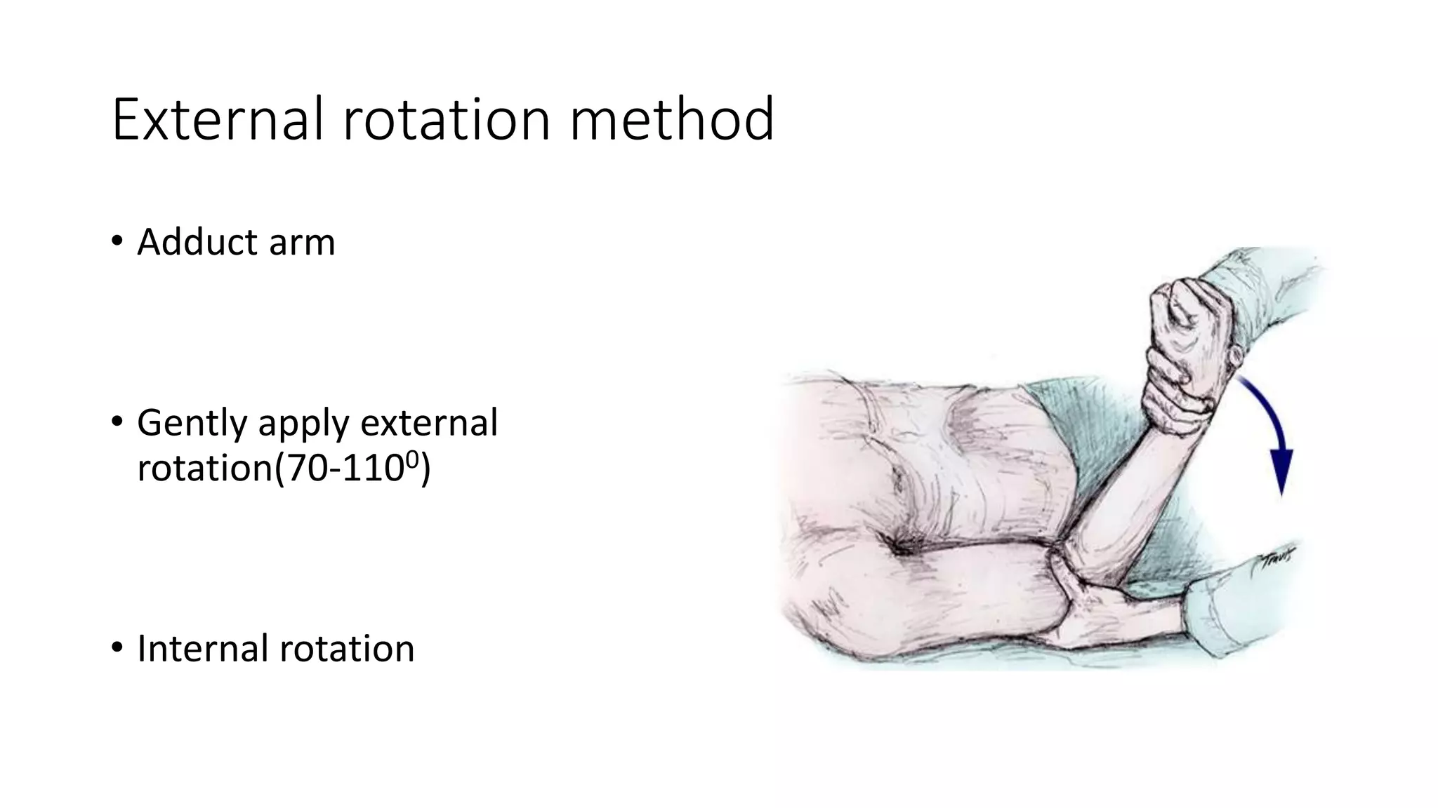 External rotation method
• Adduct arm
• Gently apply external
rotation(70-1100)
• Internal rotation
 