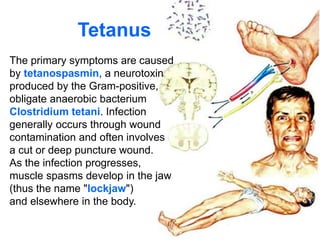 Acute specific infection_LectureENG.ppt