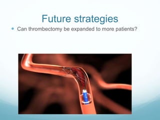 Future strategies
 Can thrombectomy be expanded to more patients?
 
