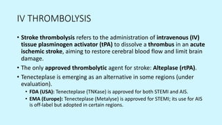 Acute Stroke Thrombolysis Time critical Team critical | PDF