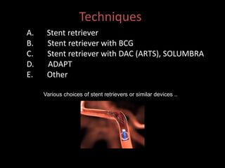 Mechanical thrombectomy with stent retriever | PPTX