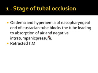  Oedema and hyperaemia of nasopharyngeal
end of eustacian tube blocks the tube leading
to absorption of air and negative
intratumpanicpressure.
 RetractedT.M
 