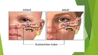 acutesuppurativeotitismedia-180923022422.pptx