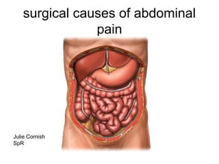 surgical causes of abdominal
pain
Julie Cornish
SpR
 